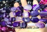 CAA2172 15.5 inches 15*20mm oval banded agate beads wholesale