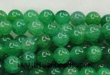 CAG420 15.5 inches 10mm round green agate beads Wholesale