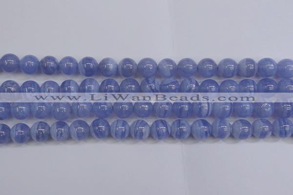 CAG5973 15.5 inches 10mm round blue lace agate beads wholesale