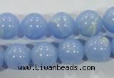 CTU1737 15.5 inches 16mm round synthetic turquoise beads