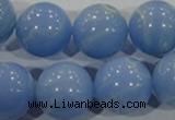 CTU1739 15.5 inches 20mm round synthetic turquoise beads