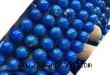 CTU3156 15 inches 10mm round gold vein howlite turquoise beads